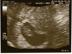 Baby2-8w5d-52308_72x54_c